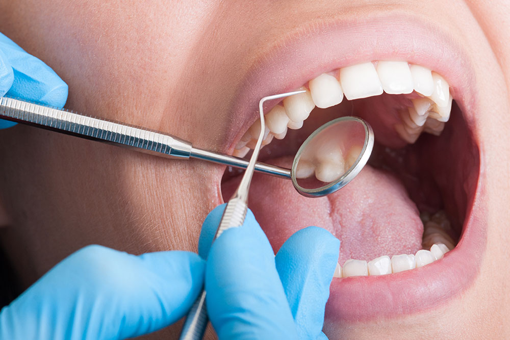 dentist cleaning patient teeth in dental clinic